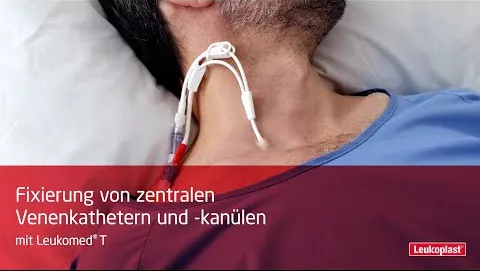 Video over LEUKOMED transp.steriele pleisters 8x10 cm, 5 st