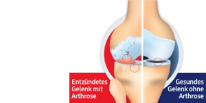 GELENCIUM arthro-mengsel, 2X100 ml