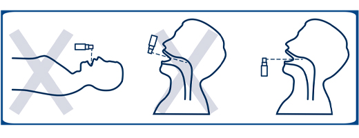 EMSER Keelpijnspray acuut, 30 ml