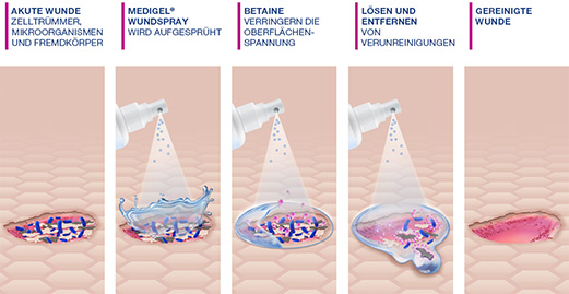 MEDIGEL Wondreinigingsspray, 50 ml