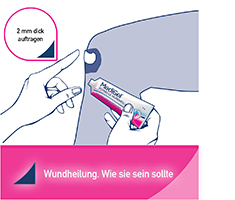 MEDIGEL snelle wondgenezing, 50 g