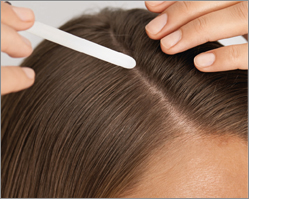LOYON voor schilferige huidaandoeningen Oplossing, 15 ml