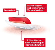 LEUKOMED T plus huidgevoelig steriel 8x10 cm, 5 st