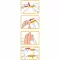 WELLION Safetylancets 28 G veiligheidsemaille, 25 stuks