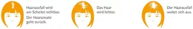 Instructions for use for Minoxidil BIO-H-TIN-Pharma 20 mg/ml spray voor vrouwen, 3X60 ml - 4