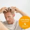 Instructions for use for Minoxidil BIO-H-TIN-Pharma 50 mg/ml spray voor mannen, 3X60 ml - 5
