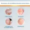 EndWarts® CLASSIC -oplossing, 3 ml