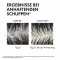 Vichy Dercos anti-roosshampoo voor de droge hoofdhuid, 500 ml