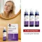 MINOXIDIL DoppelherzPharma 20 mg/ml oplossing voor vrouwen, 3X60 ml